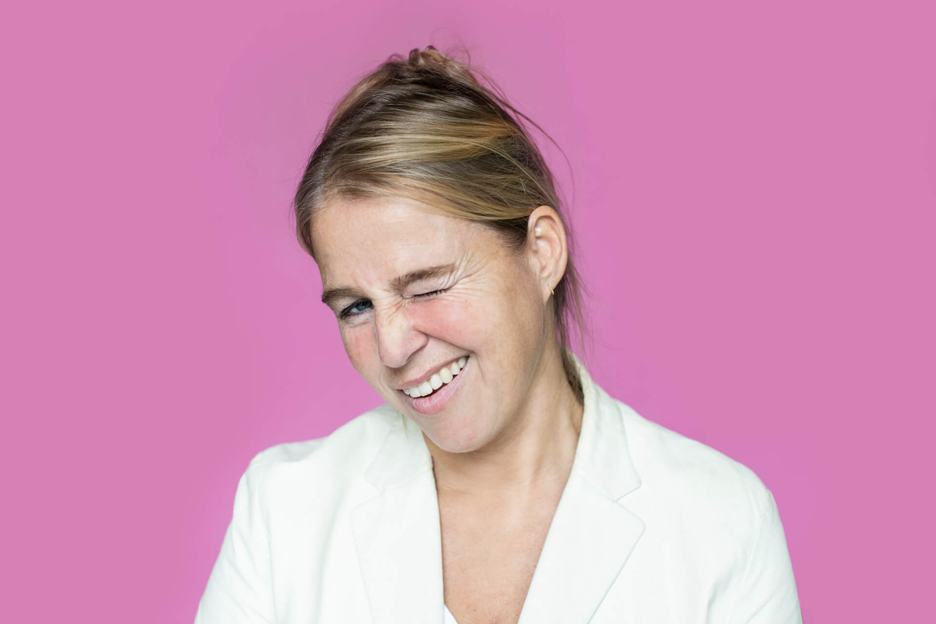 Kraaienpootjes behandeling bij Sanaetio in Almelo of op locatie